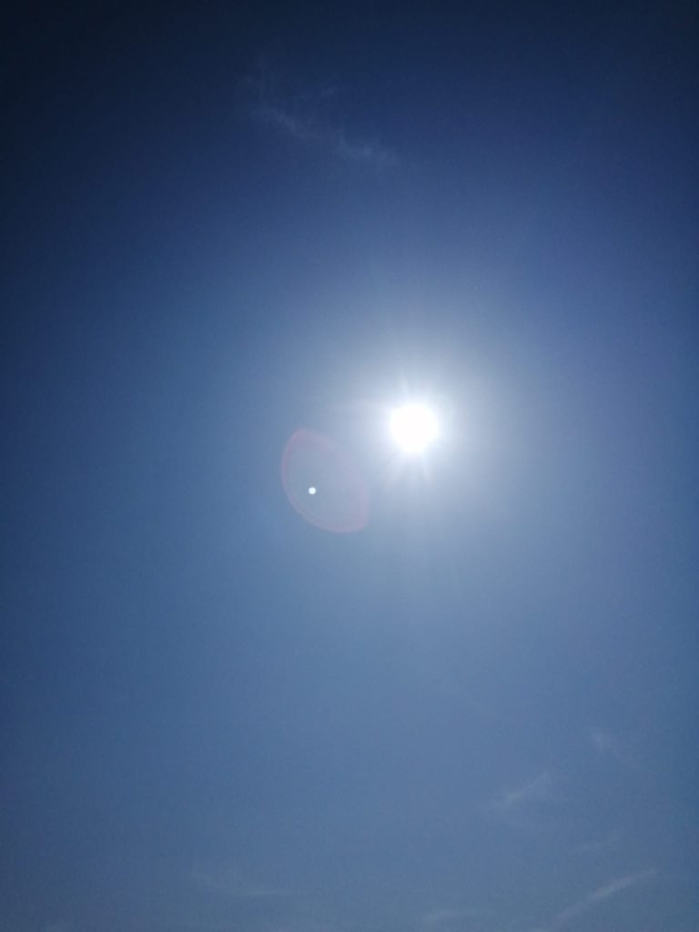 Sun spotting - Ample Therapy